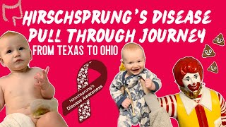 Hirschsprung’s disease pull through surgery journey [upl. by Berlin]