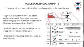 Comment Fonctionne Polysomnographie Polygraphie apnee du sommeil appareillage pour mieux dormir [upl. by Gideon]