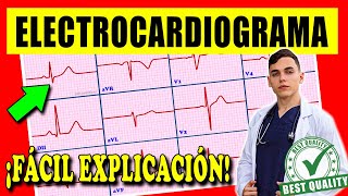 ELECTROCARDIOGRAMA Interpretación [upl. by Ameg]