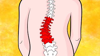 How to Fix Lumbar Scoliosis in 4 minutes naturally [upl. by Fritzsche]