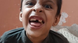 Irfan ka dant totgya 😱 fab vlogs ❣️💯❤️💕 [upl. by Azaleah]