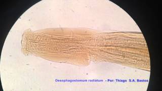 Oesophagostomum radiatum ♂ [upl. by Neall]