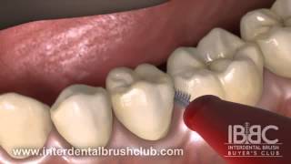 HOW TO USE AN INTERDENTAL BRUSH [upl. by Cly]