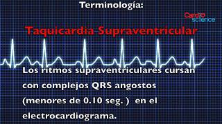 Modulo 10 0 Mecanismos Y Clasificación De Las Arritmias [upl. by Domela]