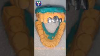 Metal Frame Work  Ceramic Four Teeth🦷 Porcelain Bridge  Tamil Dental Lab  porcelain artshorts [upl. by Hegyera]