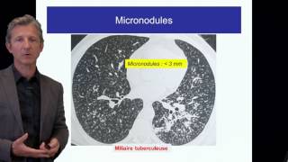 ECN PID cours 1 DFASM1 Diagnostic des PID Pr V Cottin Lyon [upl. by Cattima]