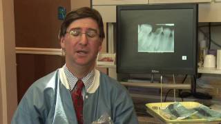 Tooth Abscess  Wisdom Tooth Abscess Symptoms [upl. by Iak428]