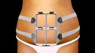 SculpSure  NonInvasive Lipolysis [upl. by Sesilu]