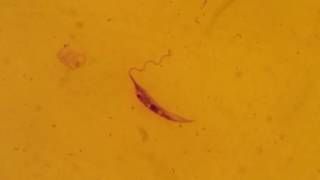 Leishmania donovani promastigote form [upl. by Nonad]