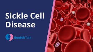 Sickle Cell Disease [upl. by Macdonell]