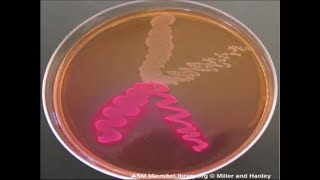 Micro Lab 6 Selective and Differential Media [upl. by Cirone]