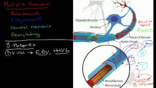 Mayo Clinic Explains Multiple Sclerosis [upl. by Annagroeg525]