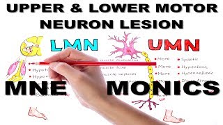 Upper amp Lower Motor Neuron Lesions  Mnemonic series 5 [upl. by Brieta730]