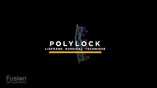 PolyLock Lisfranc Plate Surgical Technique [upl. by Solis]