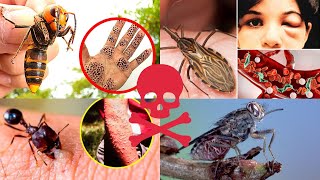 Los 5 insectos más peligros del mundo 2024 [upl. by Mcquade269]