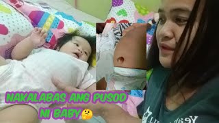 NAKAUSLI O NAKALABAS ANG PUSOD NI BABY  UMBILICAL HERNIA  ANONG DAPAT GAWIN  MOMMY SANDY VLOGS [upl. by Atalee993]