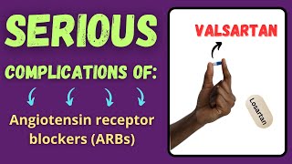 Serious side effects of Losartan Valsartan and Telmisartan  Important complications of ARB [upl. by Bev]