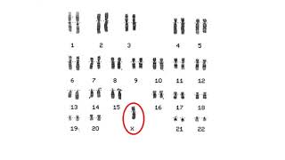 Chromosome Analysis [upl. by Eph]