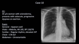 How to Interpret a Chest XRay Lesson 10  Self Assessment Part 2 [upl. by Ahteral]