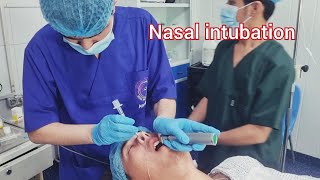 Nasotrachial intubation and Extubation a patient performed mandibular fixation [upl. by Brew]