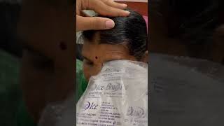 Icepack test for Myasthenia Gravis video courtesy  Dr Pratik Agrawal [upl. by Eeryt148]