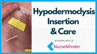 Hypodermoclysis Insertion and Care for Nurses [upl. by Gentilis]