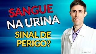 SANGUE NA URINA O QUE PODE SER DR CHARLES GENEHR [upl. by Gradey]