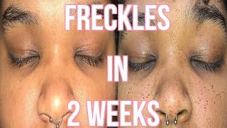 HOW I GOT REAL FRECKLES IN 2 WEEKS [upl. by Uzia]