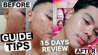 15 Days Using BRILLIANT SKIN ESSENTIAL  Rejuvinating Set Review  Kurt Ballarta [upl. by Llevol424]