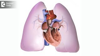 What is the treatment of Pulmonary Embolism  Dr Mohan Kumar HN [upl. by Ihtraa346]