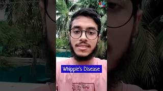 Whipples disease  Malabsorption syndrome  Pathology Medicine Surgery  Dr Med [upl. by Orpah811]