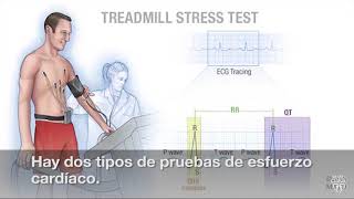 El minuto de Mayo Clinic ¿Qué es una prueba de esfuerzo cardíaco [upl. by Ong460]