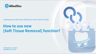 New Soft tissue removal functionAlliedstar IOS [upl. by Zakarias]