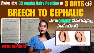 quotమా 35 వారాల బిడ్డను 3 రోజులలో Breech నుండి Cephalic ఎలా మార్చాం 🚼  How We Did Itquot breech [upl. by Siloa243]