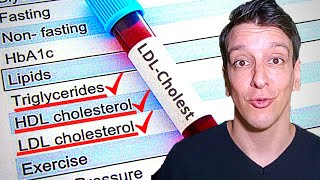 LDL Cholesterol level Your lab results explained [upl. by Hallock]