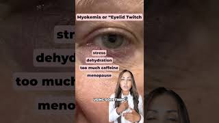 Does your eyelid twitch short shorts healthtips lifehacks healthyliving symptoms eyes [upl. by Earej104]