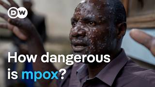 New mpox virus Why is it spreading so quickly  DW News [upl. by Vezza]