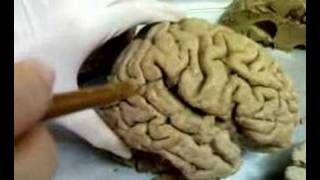 gyrussulcus of cerebrum [upl. by Lah]