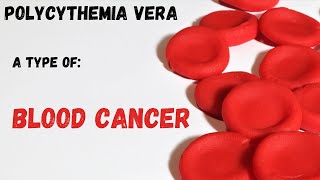 THICK BLOOD A type of blood cancer Polycythemia vera  Symptoms and treatment [upl. by Durwin]