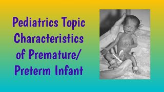 Characteristics of Premature Infant Preterm Babyenglishहिंदी [upl. by Aelsel]