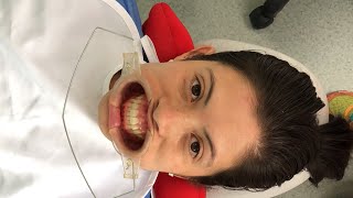 Cómo hacer un Blanqueamiento dental EN VIVO [upl. by Hedy]