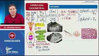 Hiperplasia Endometrial  Repaso ENAM [upl. by Sirtaeb]