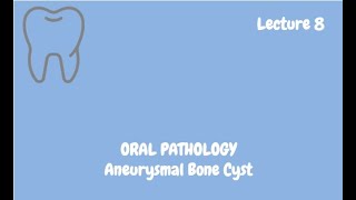 Aneurysmal Bone Cyst Complete Lecture  For NBDE NDEB MDS amp FCPS [upl. by Ynnij643]