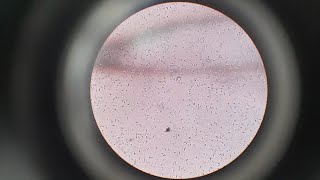 Semen Analysis Test  Microscopic Examination of Semen Test  Semen Test Procedure [upl. by Kristoffer]