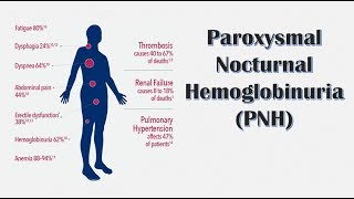 Hematology 🔤  Paroxysmal Nocturnal Hemoglobinuria PNH [upl. by Anayrb199]