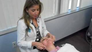 Ultherapy in San Diego  Skin Tightening  Dr Sabrina Fabi [upl. by Bevvy]