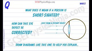 How to Correct Short Sighted Vision  Physics of Light [upl. by Noynek]