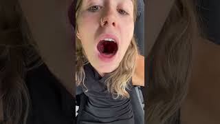 When are you coming to fix my throat ASMR ZOERHODEASMR ASMRGIRL OF [upl. by Kimmel]