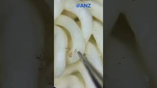 Maggi under The microscope 😲shorts viral youtubeshorts microscope [upl. by Iilek596]