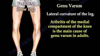 Alignment Of The Lower Limb  Everything You Need To Know  Dr Nabil Ebraheim [upl. by Gnilrits]